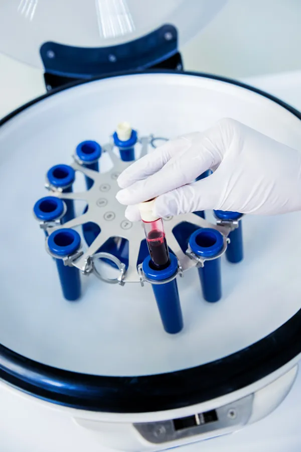 A blood centrifuge. Get Iron Metabolism testing from Morgan Burns, APRN in New Smyrna Beach.