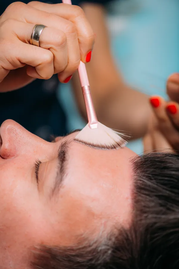 Close-up of a man receiving a chemical peel treatment on his forehead from professional who work with Brandi Terra, NP at Oak & Stone Wellness on San Diego.