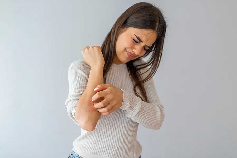 A young brunette woman scratches her forearm and winces in discomfort. Get treatment for eczema from Brandi Terra, NP at Oak & Stone Wellness in San Diego.