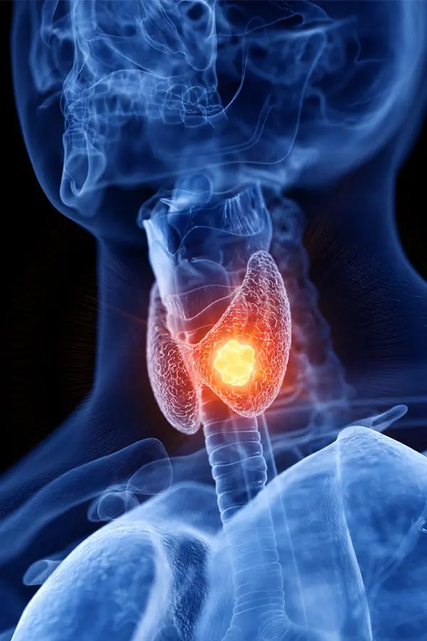 A 3D illustration of an x-ray of a human neck, highlighting the thyroid. Get help with thyroid imbalance from Brandi Terra, NP at Oak & Stone Wellness in San Diego.